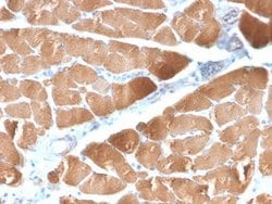 Desmin Antibody (DES/2960R) - Azide and BSA Free, Novus Biologicals 100